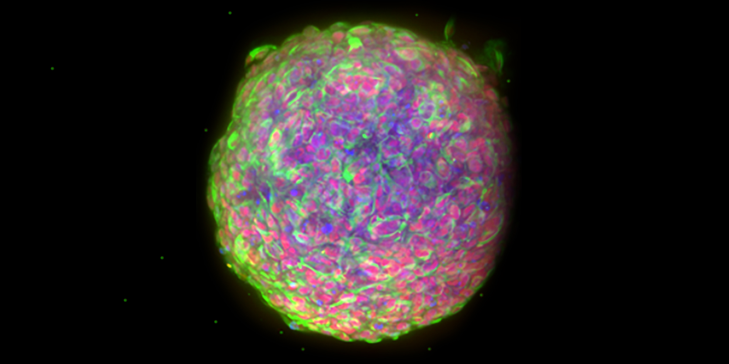 3D tumour spheroid